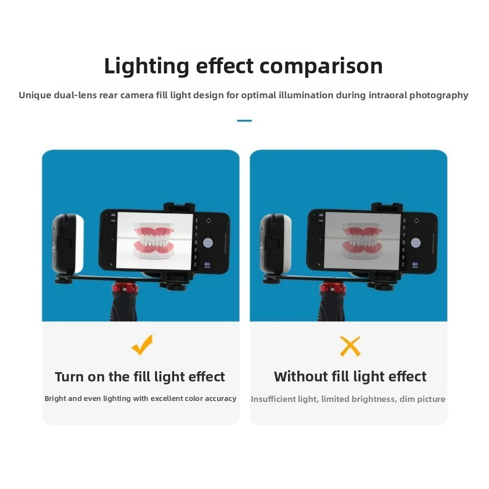 Dental Photography Light, Blue - Photography Lighting Kit Portable 评论和价格
